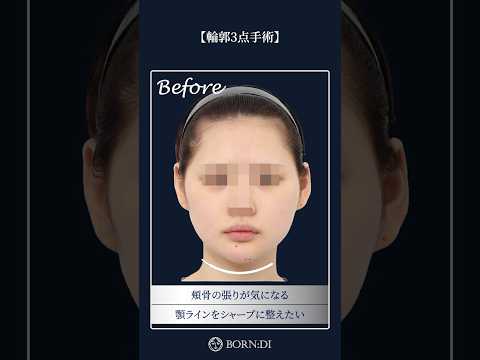 ボンディ整形外科ビフォーアフターのショート動画サムネイル