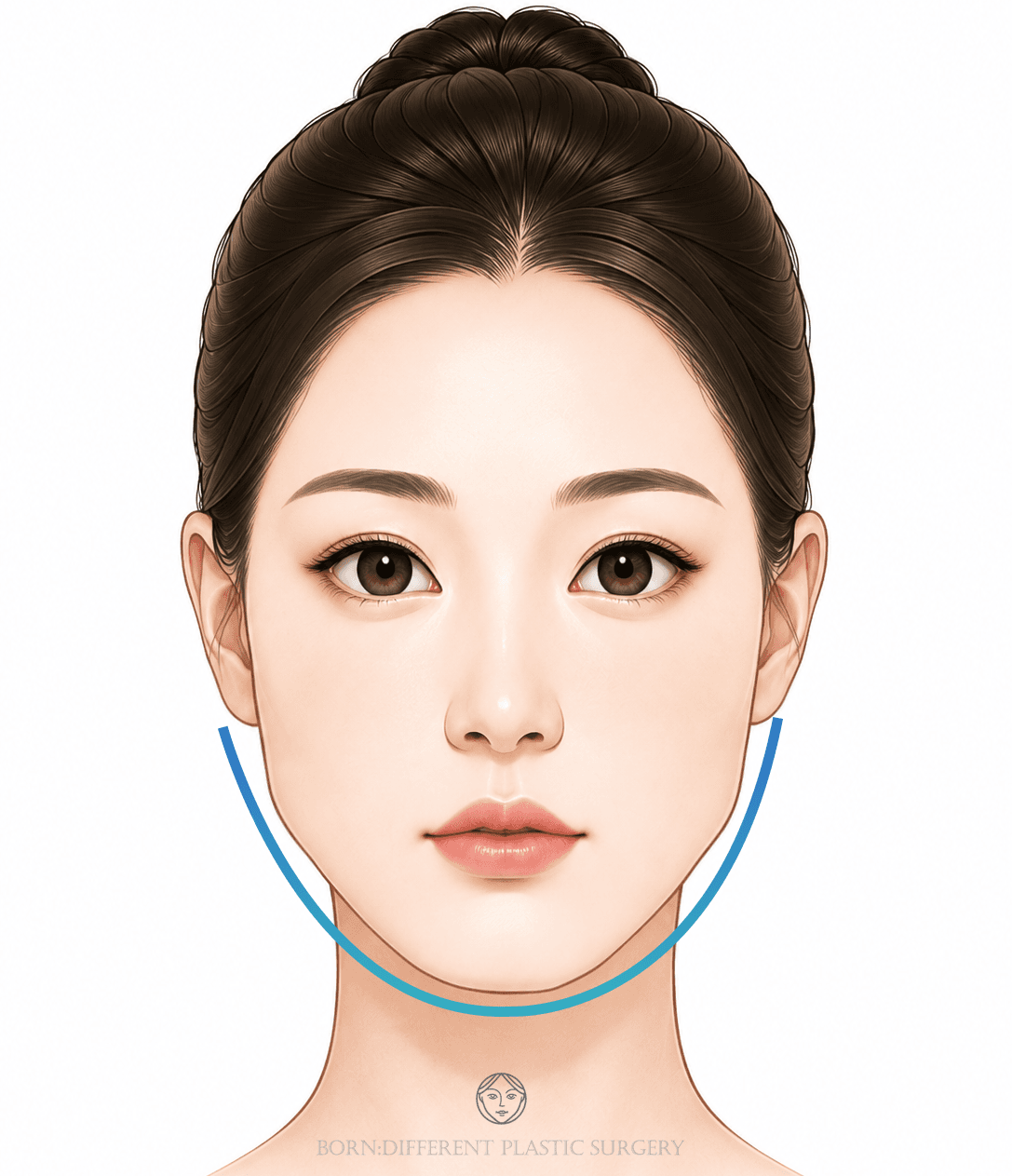 回し切りのイメージイラスト